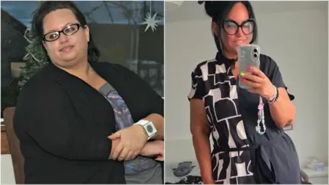 Many Lost Weight Using Jabs – Then Came the Sagging Skin