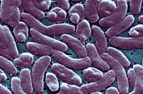 The Bayou State Records 5 Fatalities from Necrotizing Bacteria in Gulf Waters